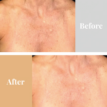 Load image into Gallery viewer, Omnilux ContourTM  NECK & DÉCOLLETÉ