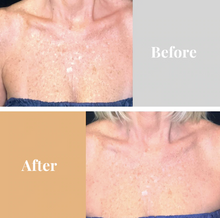 Load image into Gallery viewer, Omnilux ContourTM  NECK & DÉCOLLETÉ